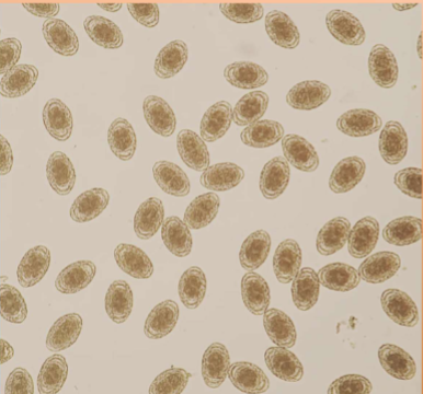 <p>symptoms of <span><span>Dioctophyma renale</span></span></p>