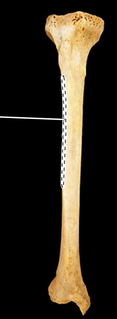 <p>Name the highlighted portion.</p><p>(Tibia, anterior view, right side).</p>