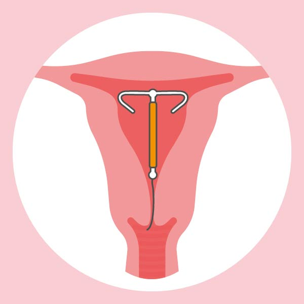 <p>de koperspiraal</p>