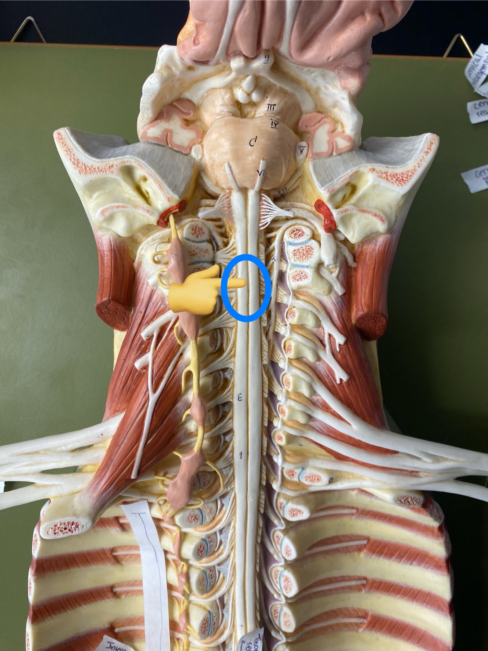 <p>ID enlargement</p>