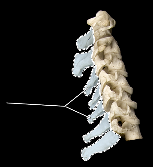 <p>What part of the vertebra is highlighted?</p><p>What region of the vertebral column is this?</p><p>(Lateral view).</p>
