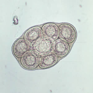 <p>A cestode parasite causing cestodiasis, transmitted via ingestion of infected fleas, leading to proglottids in feces and anal pruritus.</p>