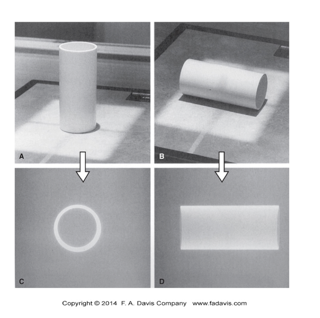 <p>Curved Planes:</p><ul><li><p>How to shoot Curved Planes compared to the image receptor?</p></li><li><p>How many planes is needed to view?</p></li></ul><p></p><p></p>