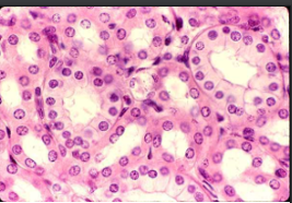 <p>Description: Single layer of cubelike cells with large, spherical central nuclei</p><p>Function: Secretion and absorption, production of mucous coat, movement of respiratory mucus </p><p>Location: Kidney tubules, ducts and secretory portions of small glands, and liver</p>