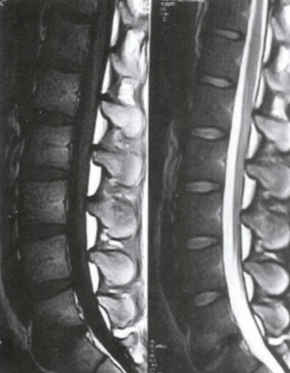 <p>Which side is T1 which side is T2?</p>