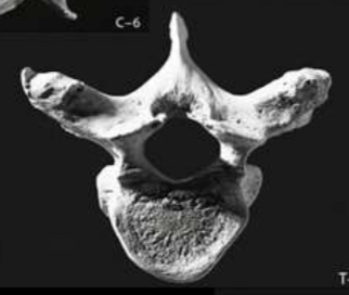 <p>Heart-shaped, protrusions present to articulate with ribs</p>