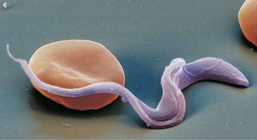 <ul><li><p>cardiovascular/lymphatic protozoal disease</p></li><li><p>cause: <em>T. cruzi</em></p><ul><li><p>found in Latin America (few in southern USA)</p></li><li><p>virulence: transplacental (chronic); multiples in host</p></li></ul></li><li><p>transmission: reduviid (kissing) bug; contaminated feces</p></li><li><p>symptoms: fever, swollen glands, swelling at bite site; damaged nerves (chronic)</p></li><li><p>treatment: NONE (difficult)</p></li></ul><p></p>