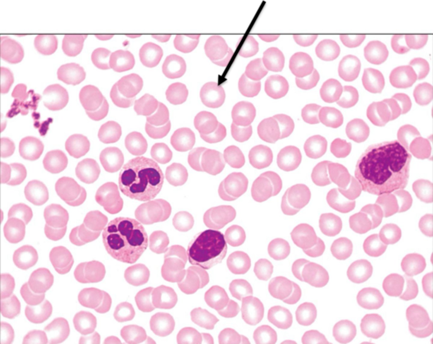 <p>biconcave shape, large surface area for gas exchange, filled with hemoglobin. AKA RBC.</p>