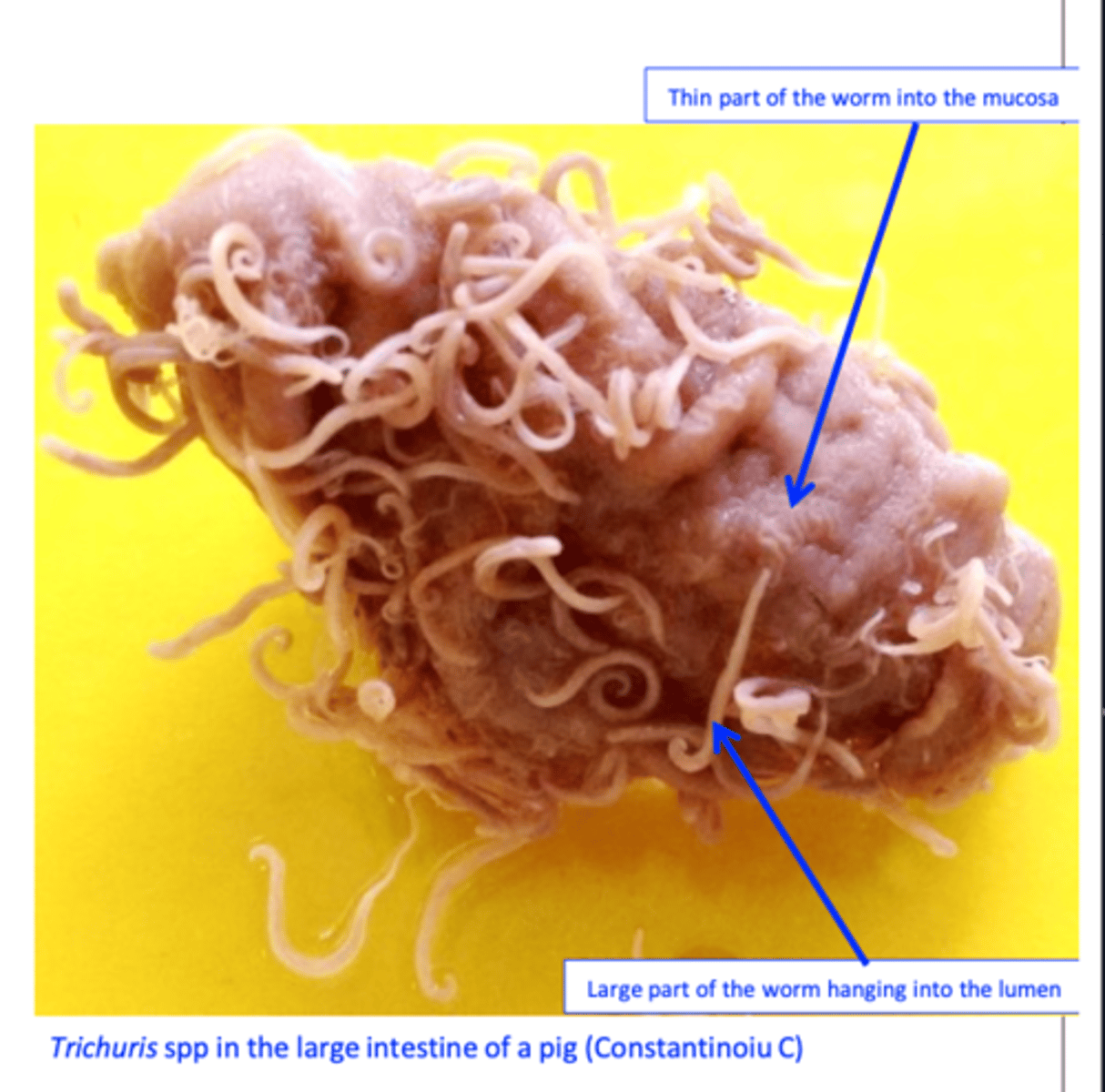 <p>Location: caecum and colon:</p><p>may infect humans</p>
