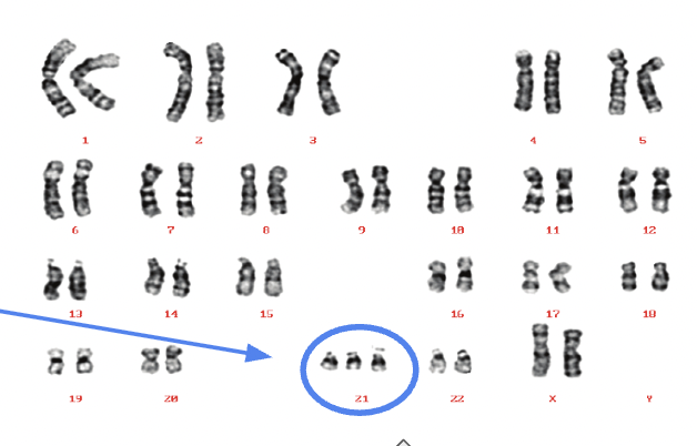 <p>Picture of chromosomes</p>