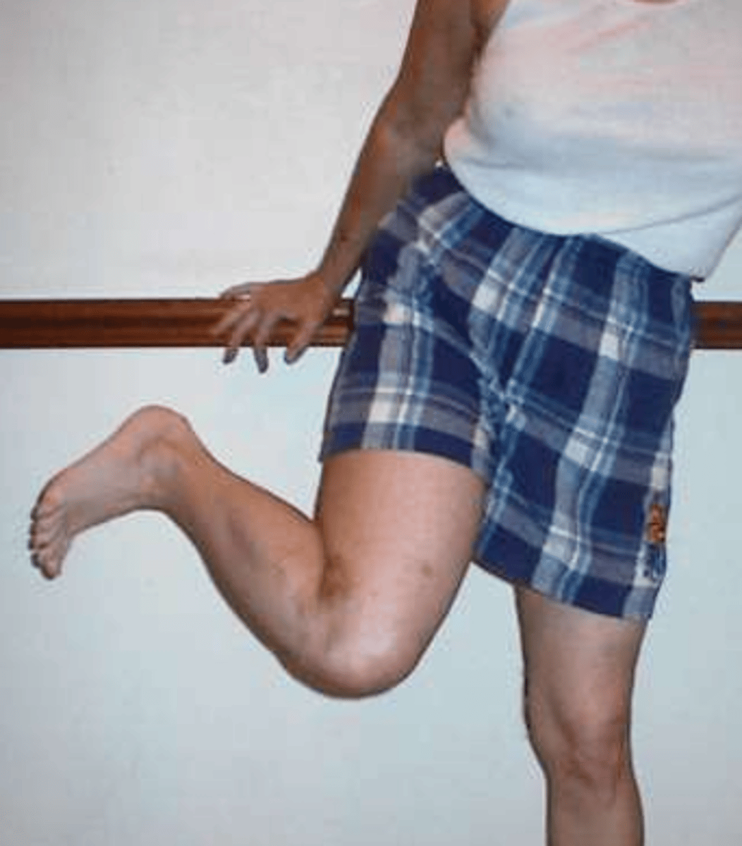 <p>hip flexion, hip abduction, hip IR, knee flexion</p>