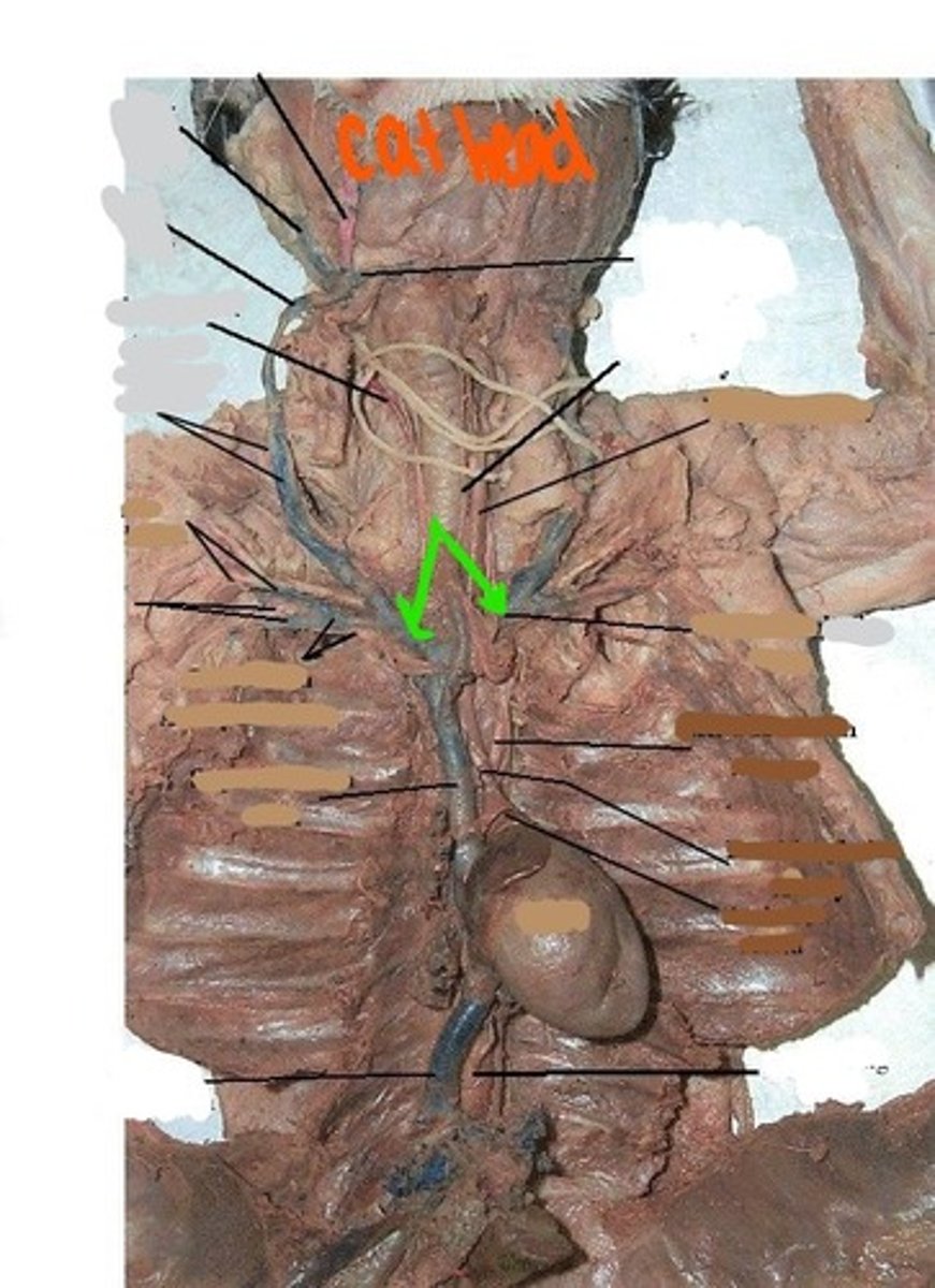 <p>identify this vein</p>