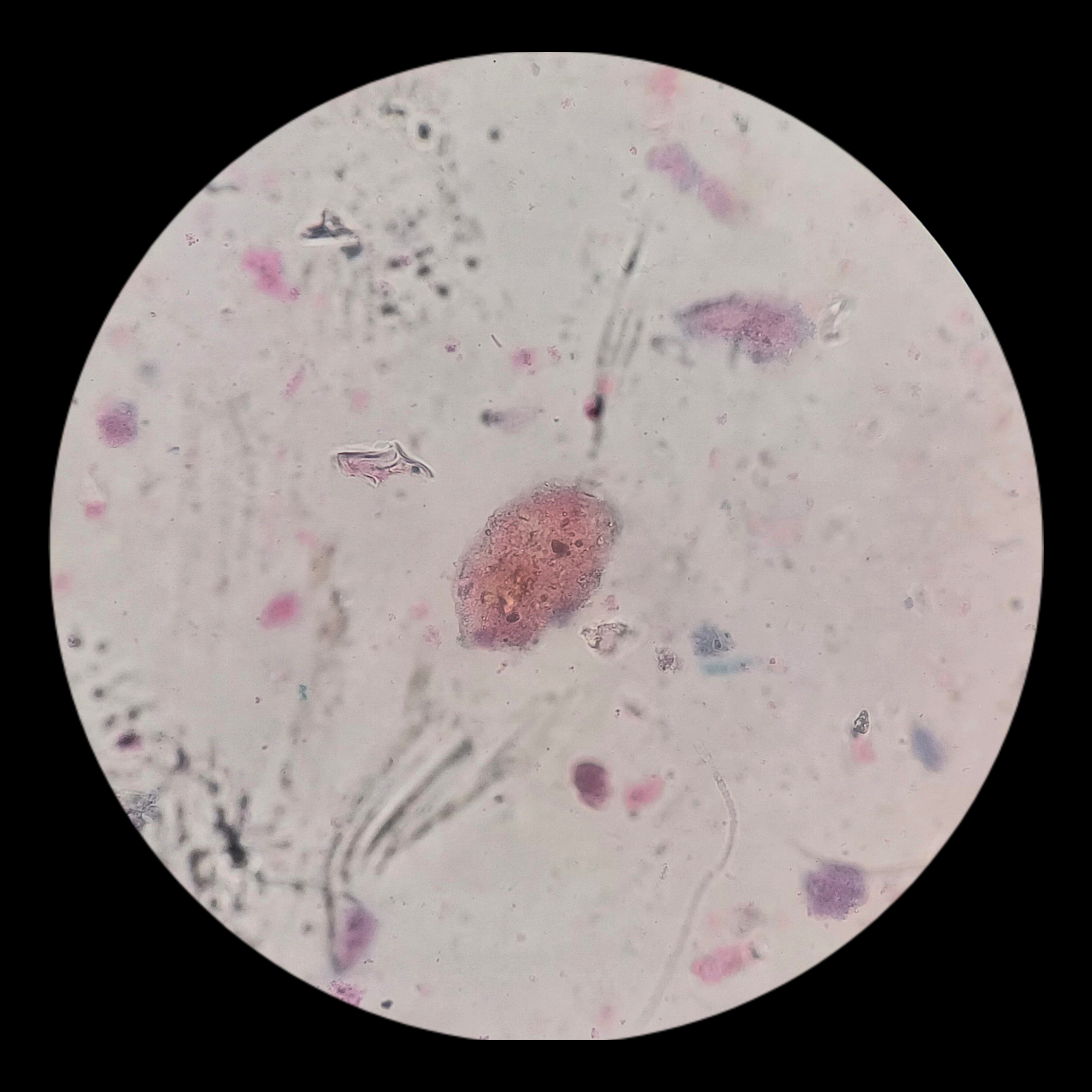 <p><strong>General characteristics:</strong></p><ul><li><p>The only ciliate known to infect humans.</p></li><li><p>Causes balantidiasis, an intestinal infection.</p></li><li><p>Usually transmitted through contaminated food or water.</p></li><li><p>Uses cilia for movement.</p></li></ul><p></p>