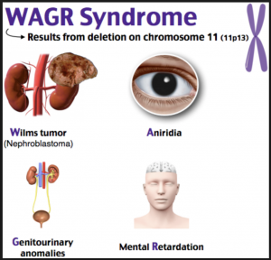 <p>Wilms Tumor Gene- deletion on chromosome 11p13</p>