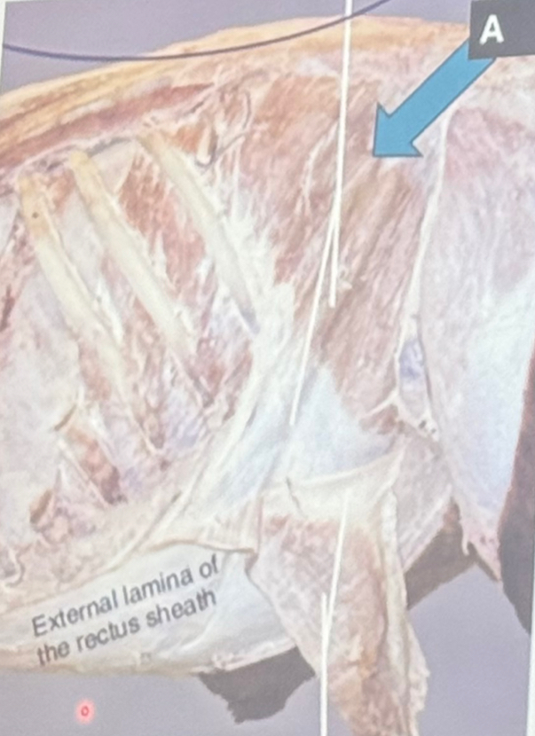 <p>Identify the structure labelled A.</p>