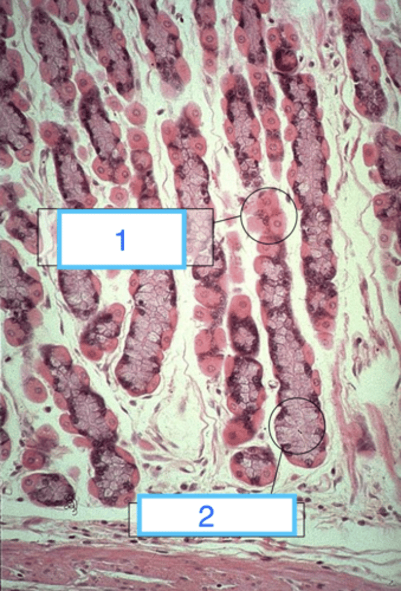 <p>what are the cells at 1?</p>