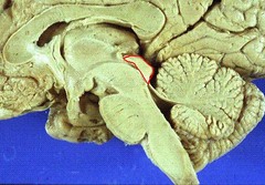 <p>sensory region of midbrain; contains colliculi</p>