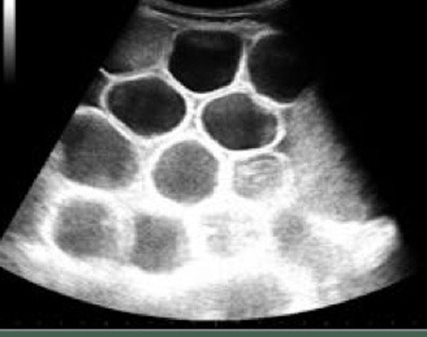 <p>What part of the intestine is distended here?</p>