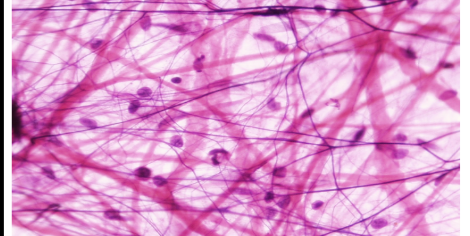 <p>Function: Surrounds and Protects Tissue</p><p>Location: Papillary Layer of dermis</p><p>Hair Like fibers*</p>