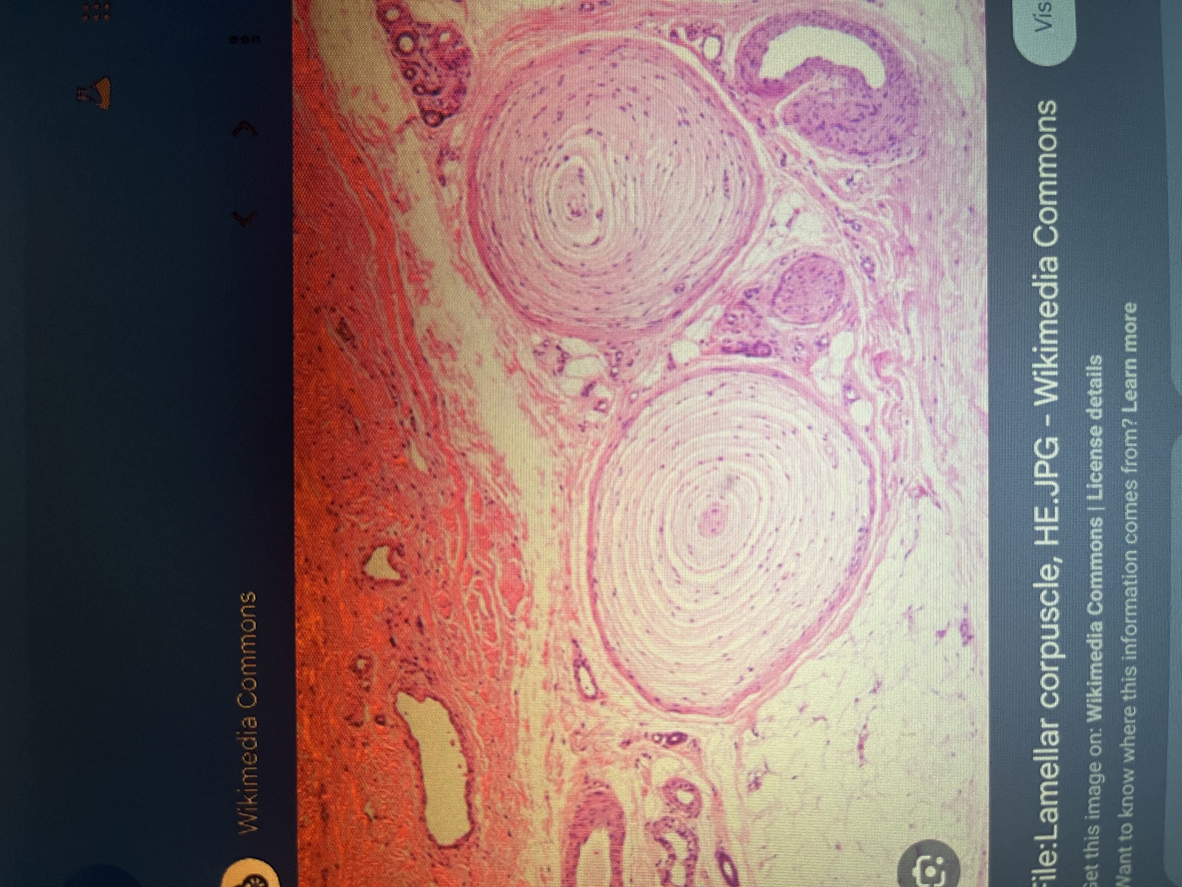 <p>Pacinian corpuscle; a deep pressure and vibration receptor in the dermis.</p>