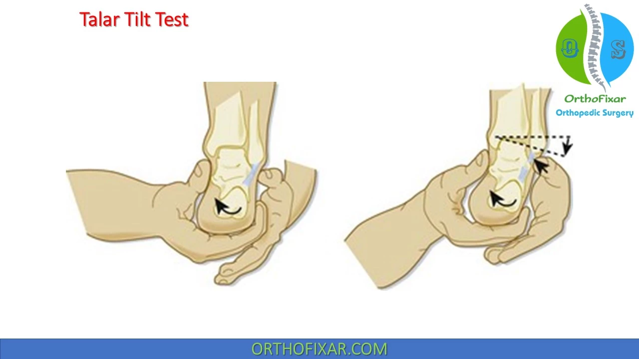 CF ligament; heel and tilt talus (test for CF ligament is ruptured)
