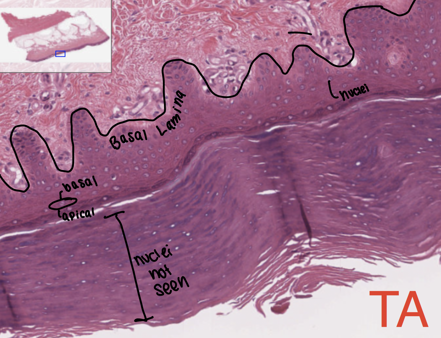 <p>found in the skin. thick skin is palms and bottoms of the feet, thin skin is found everywhere else</p>