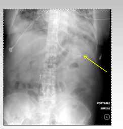 <p>what type of tube is this?</p>