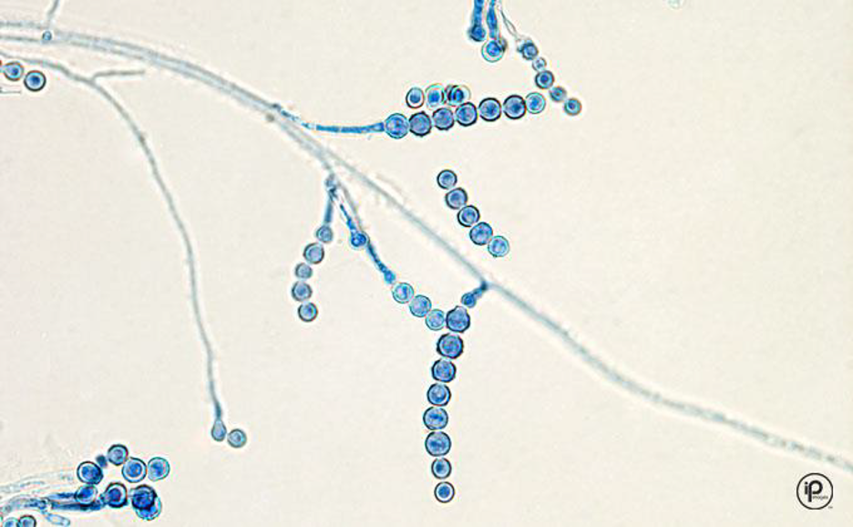 <p>Microscopic morphology of: Scopulariopsis</p>