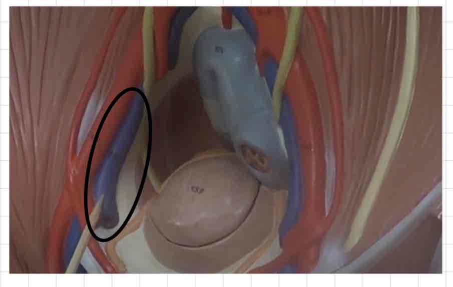 <p>what is this? (torso model)</p>