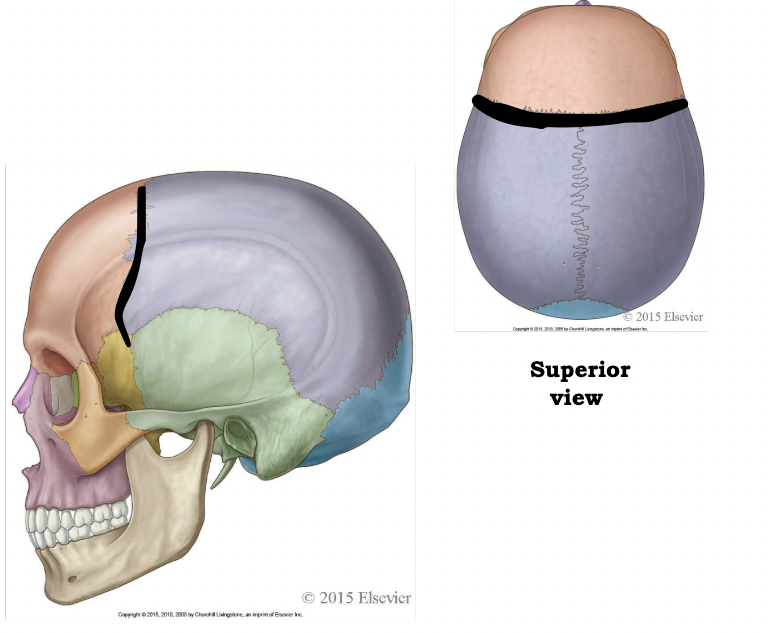 <p>which suture is highlighted here</p>