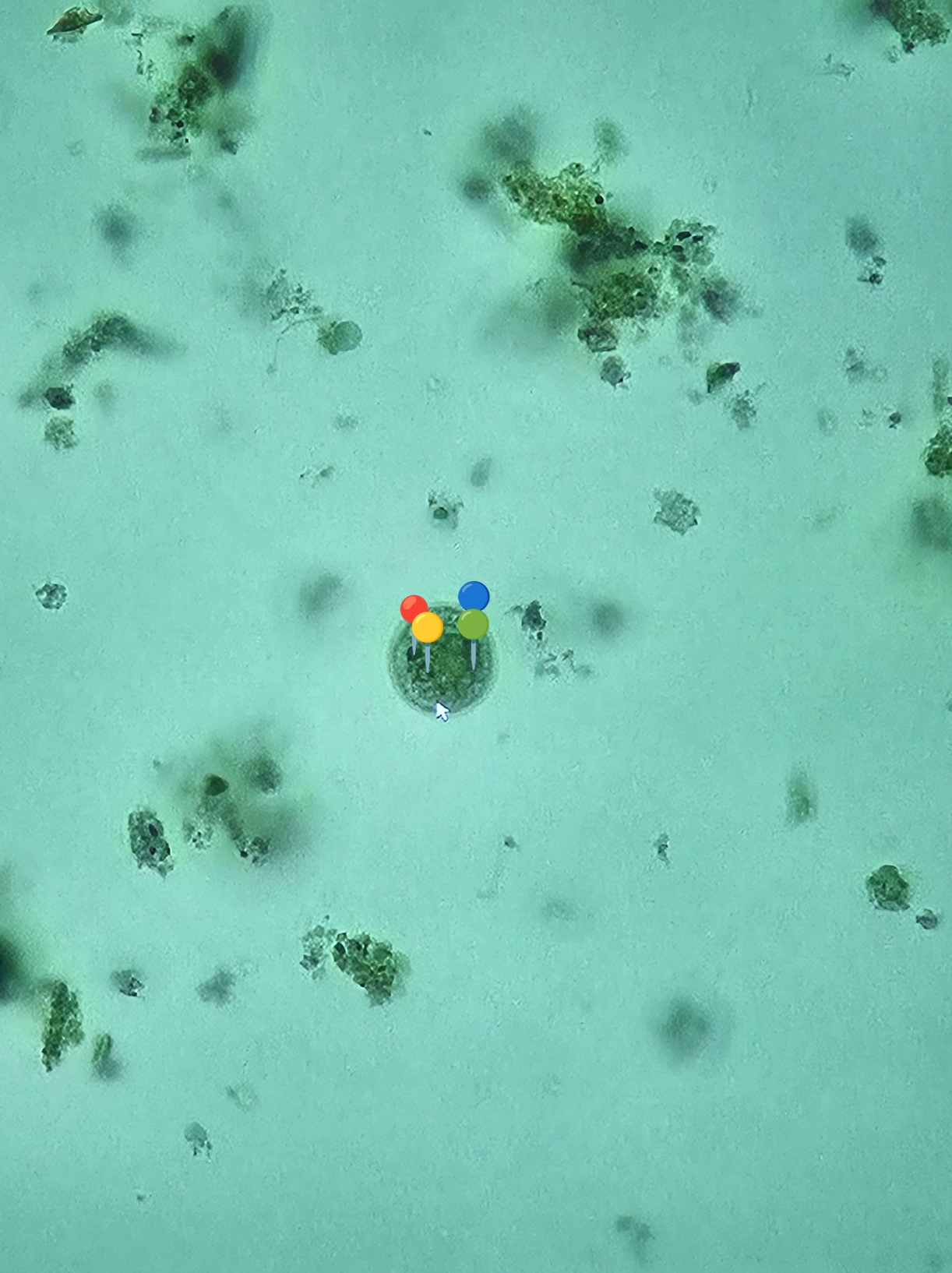 <p><strong><em>Entamoeba coli</em></strong></p><p>(Cysta)</p><p></p><p></p><p><strong>Organelle:</strong></p><p></p><ul><li><p><span data-name="red_circle" data-type="emoji">🔴</span><span data-name="yellow_circle" data-type="emoji">🟡</span><span data-name="green_circle" data-type="emoji">🟢</span><span data-name="blue_circle" data-type="emoji">🔵</span><span> - jądra komórkowe.</span></p></li></ul><p></p><p></p><p><strong>Parazytoza: </strong><em>Pełzakowica</em></p>