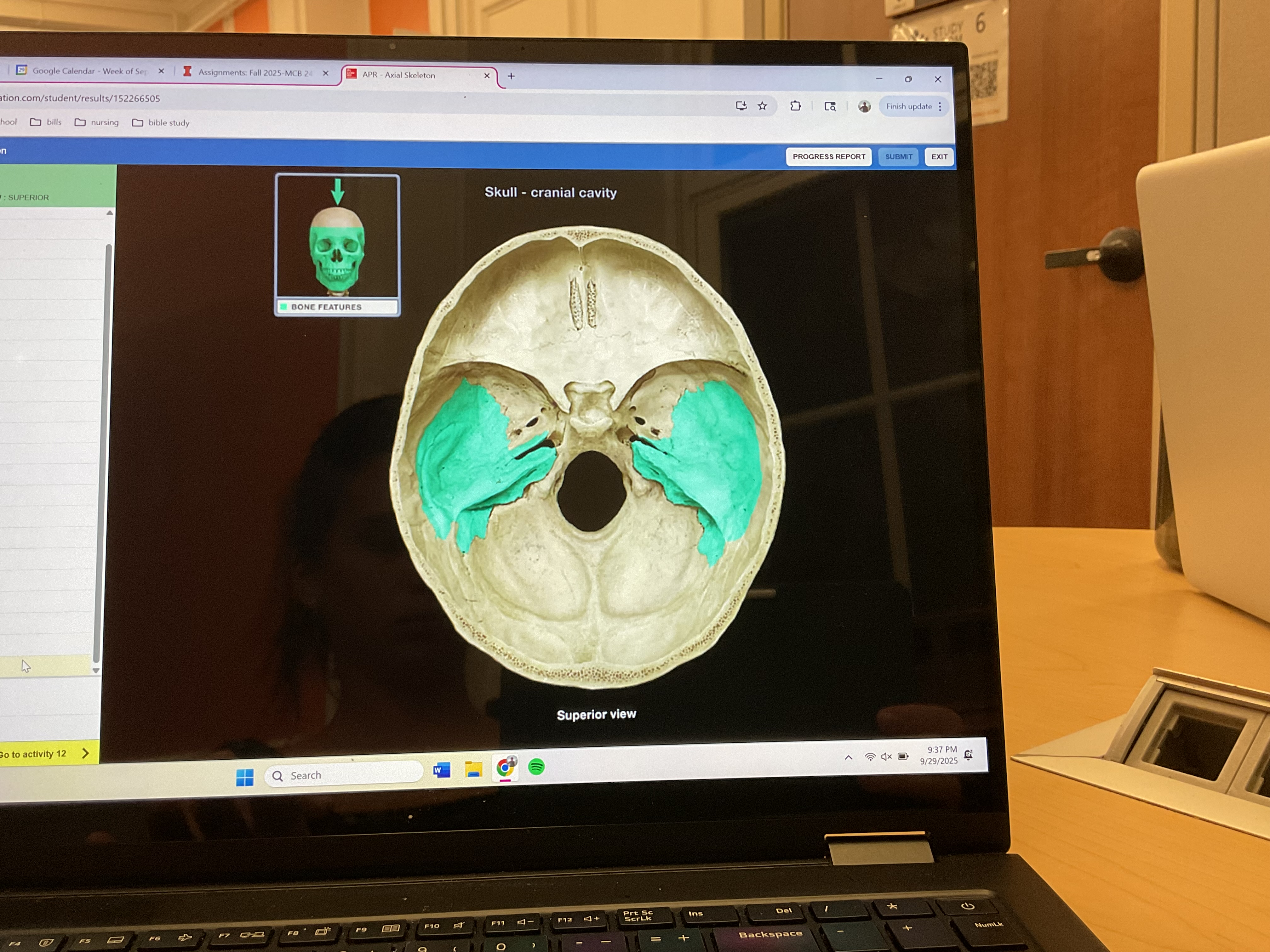 <p>Temporal bone </p>