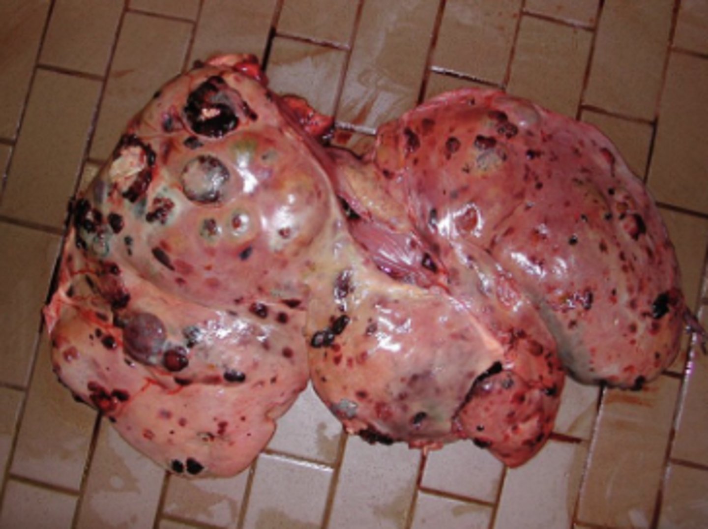 <p>How would you describe this lesion?</p>