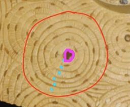 <p>Concentric lamella(blue dots)</p>
