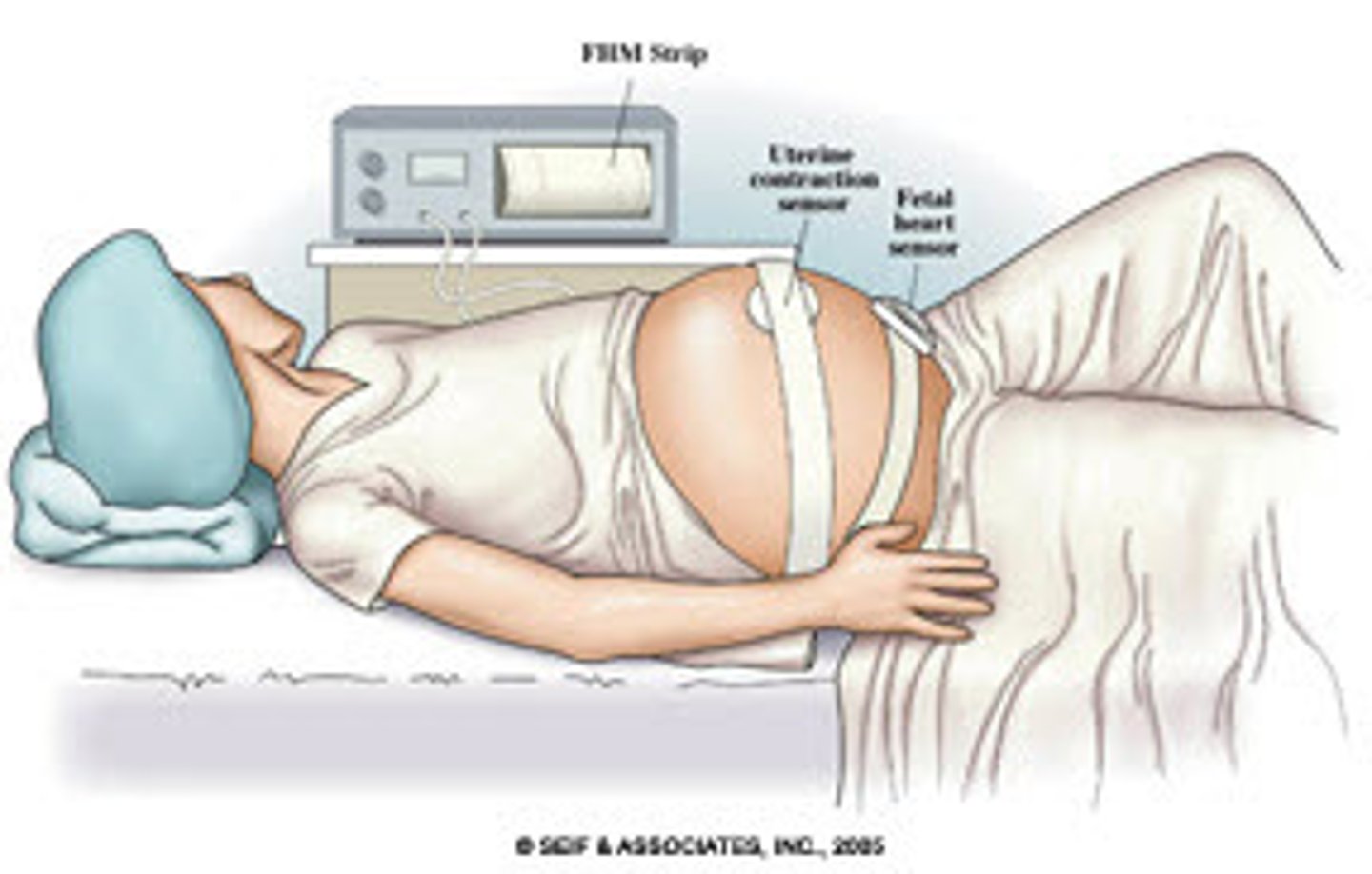<p>15-22 weeks of gestation</p><p>maternal serum alpha-fetoprotein (MSAFP) screen. It's usually as part of a set of tests, which screen for genetic problems, called the quad screen.</p><p>AFP is a substance made in the liver of an unborn baby (fetus).</p>