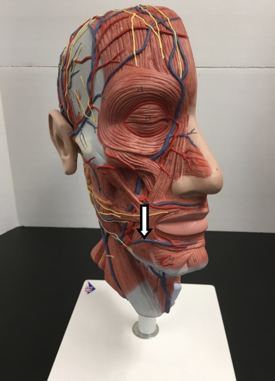 <p><span>Name the muscle labeled with the white arrow below AND name ONE action .</span></p>