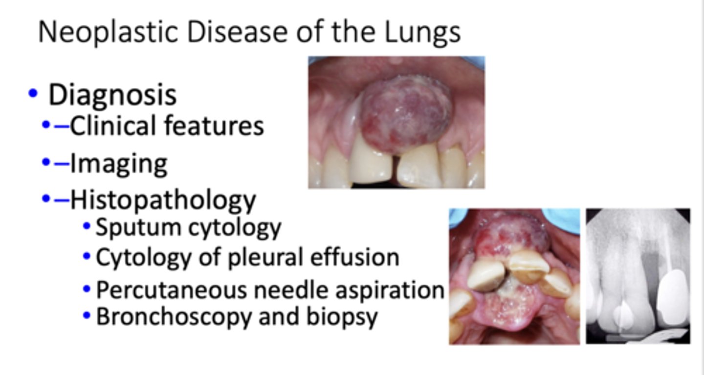 <p>- Clinical features</p><p>- Imaging</p><p>- Histopathology</p>