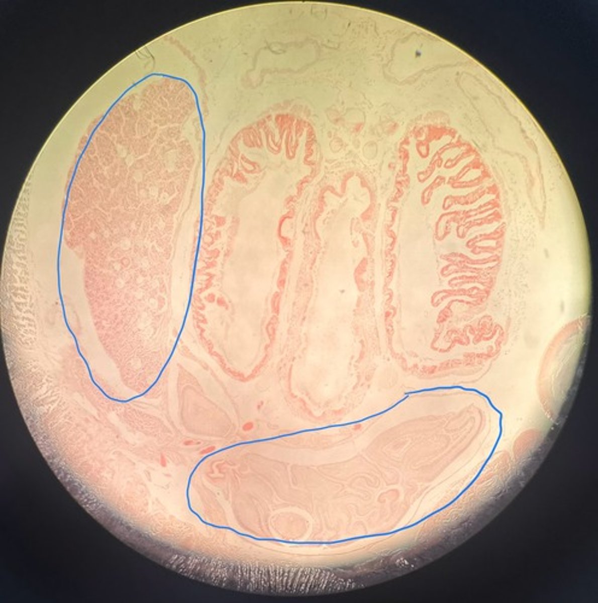 <p>What are the circled structures? What organism does this belong to?</p>