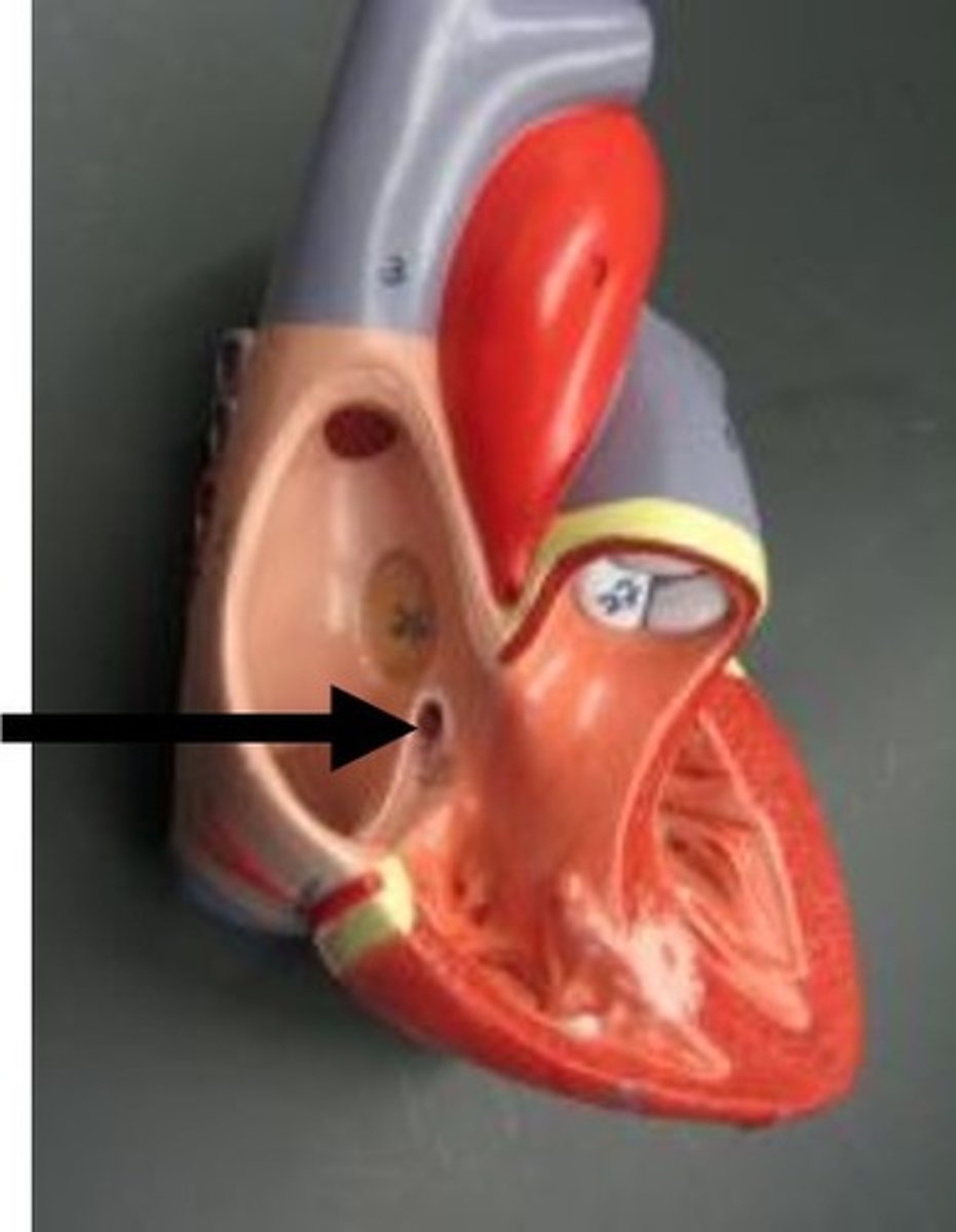 <p>Where deoxygenated blood from the heart's own circulation returns to the right atrium.</p>