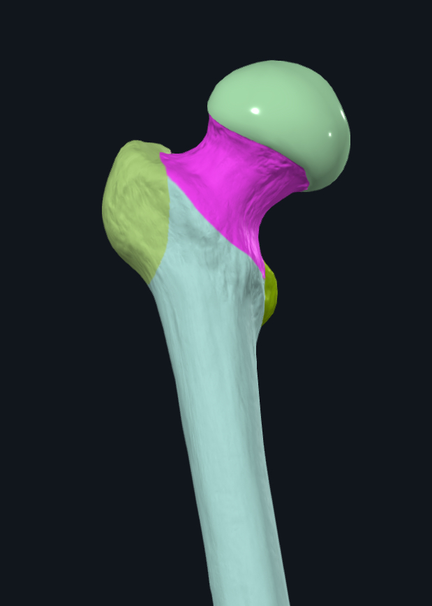 term image
