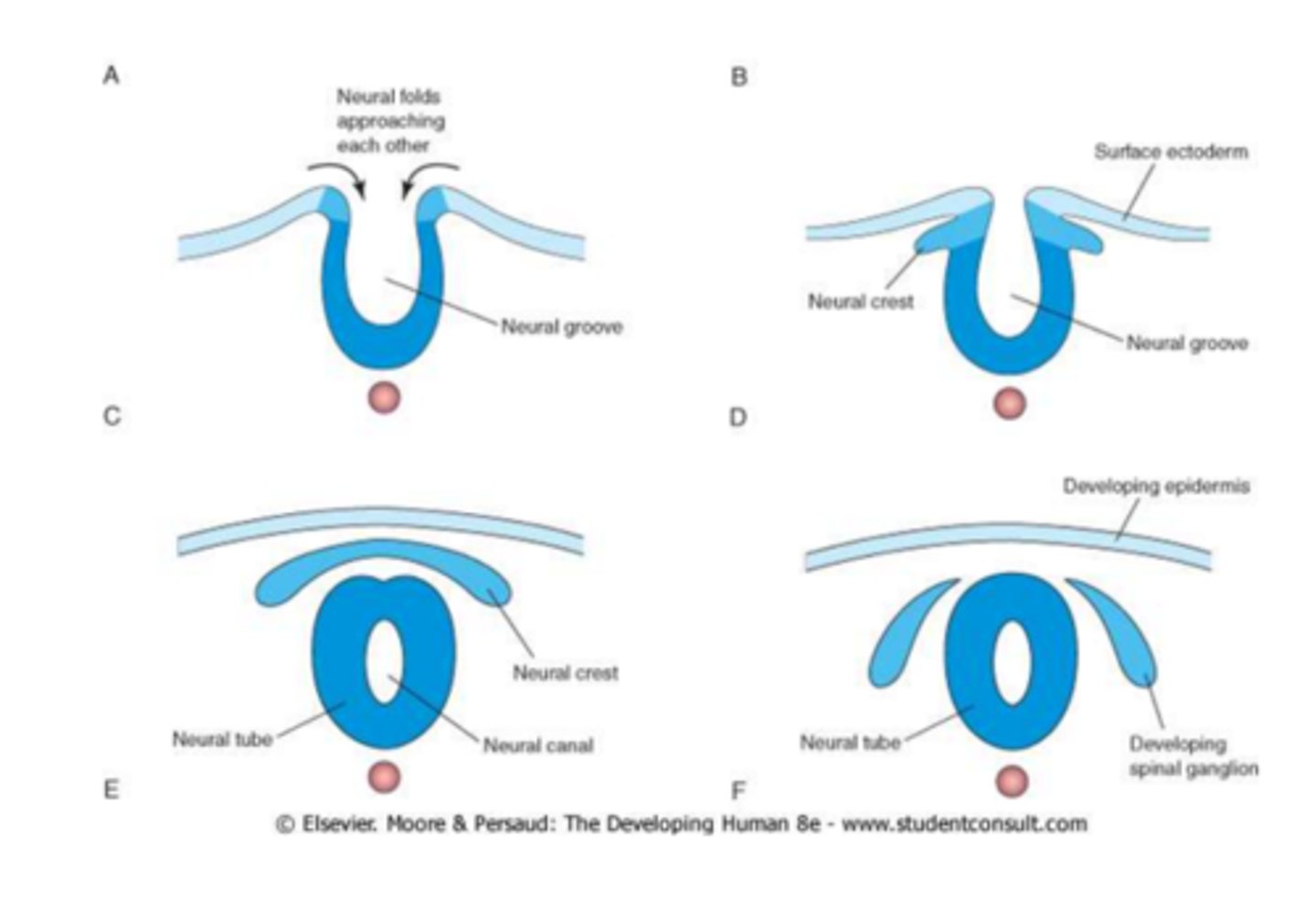 <p>improper/no fusion of tube</p><p>incomplete closure of neural tube</p>