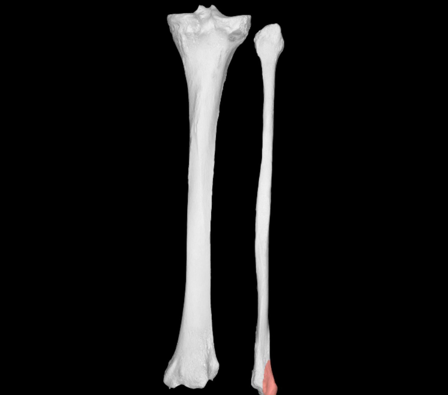 <p>like styloid process of fibula </p>