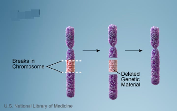 <p>a type of chromosomal aberration in which a segment of the chromosome is removed or lost.</p>