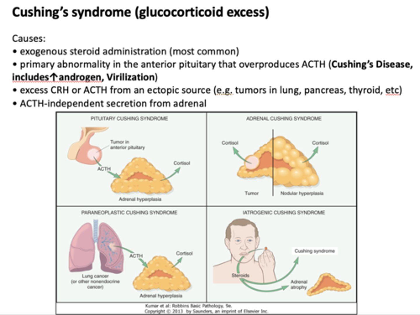 <p>Cushing's syndrome</p>