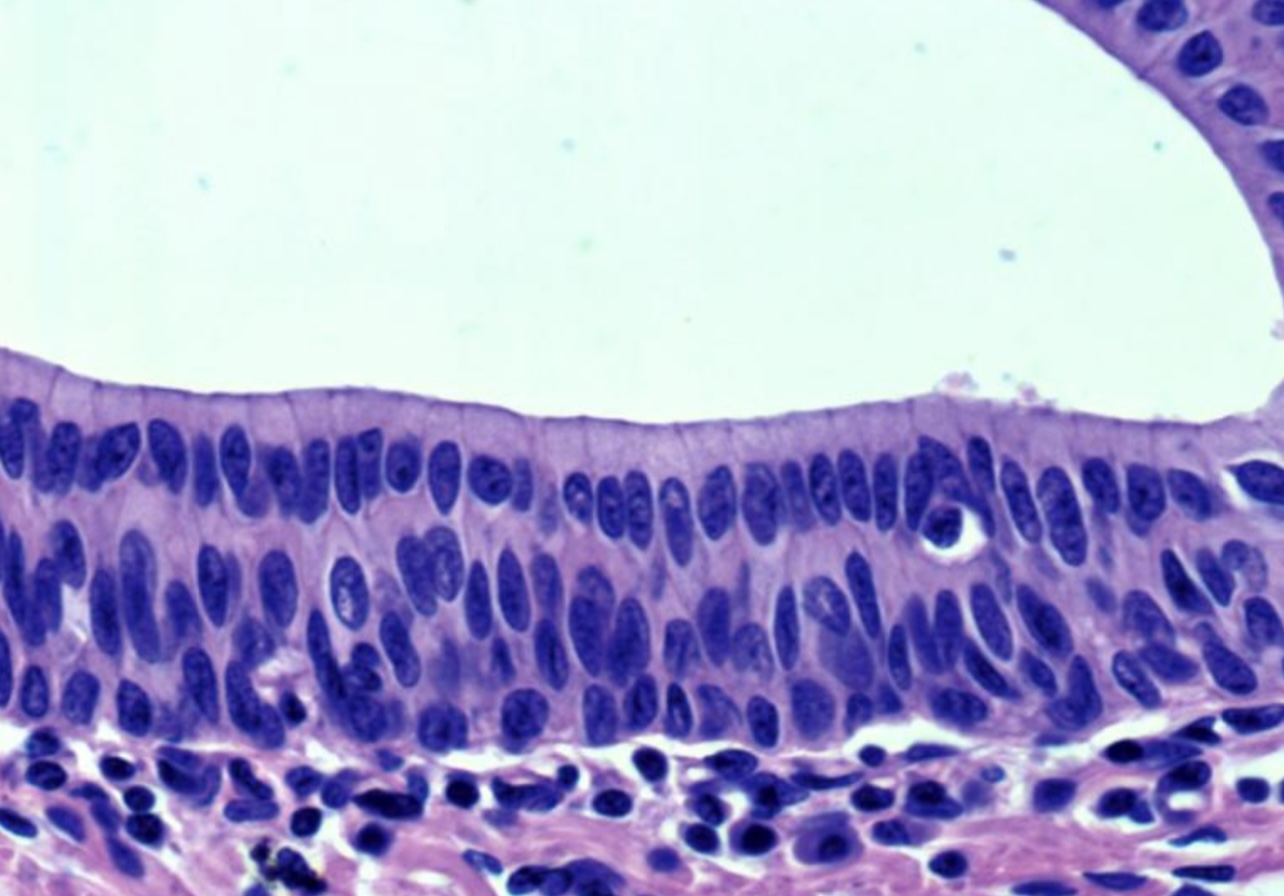 <p>What type of epithelium is this?</p>