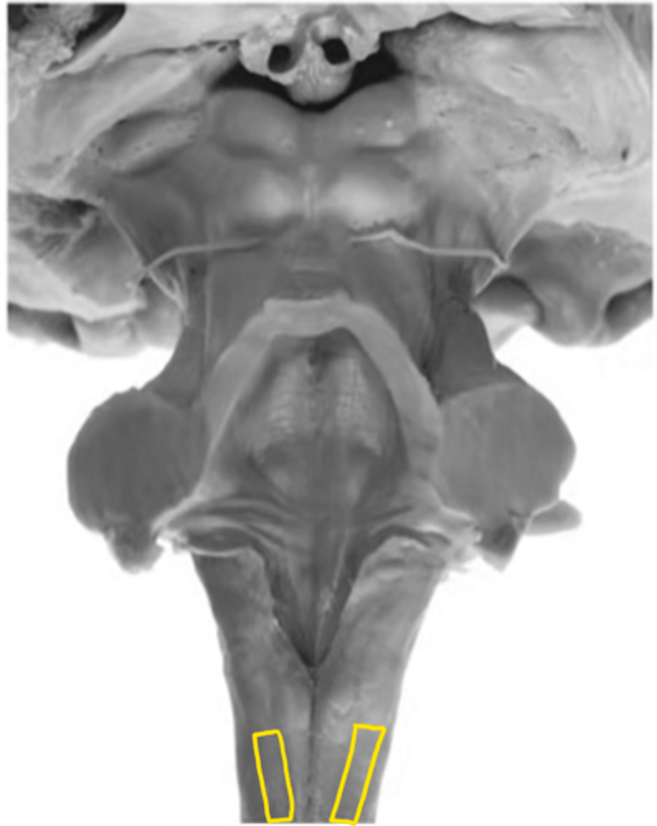 <p>ID the fibers</p>