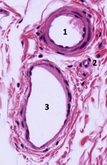 <p>what types of blood vessels?</p>