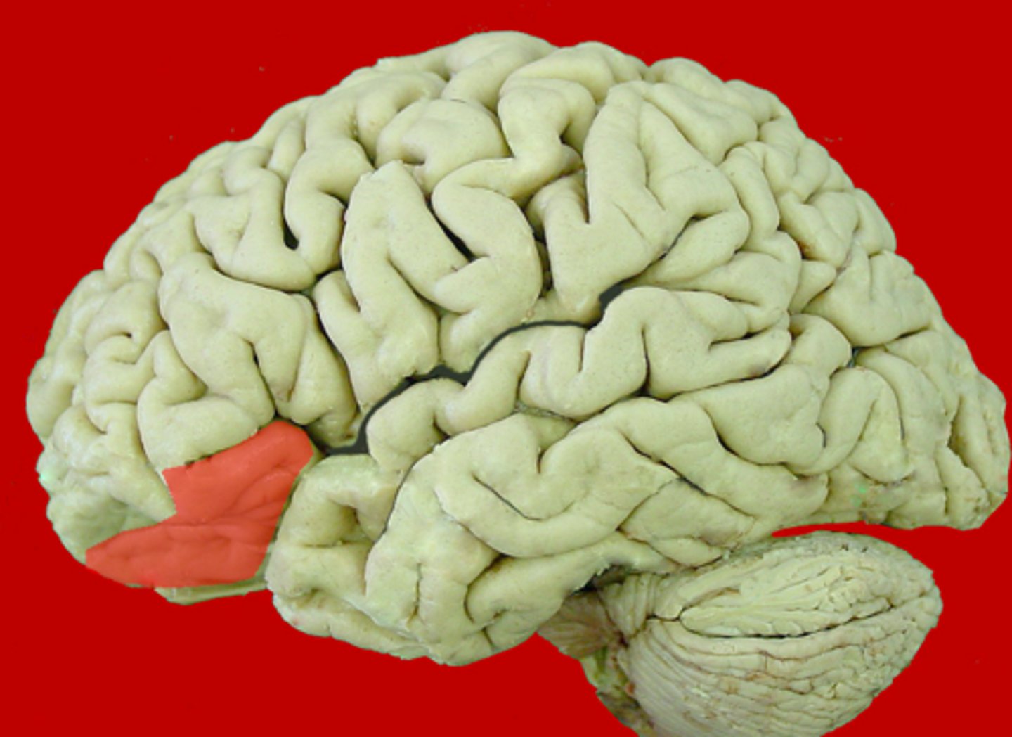 <p>most anterior portion of inferior frontal gyrus</p>
