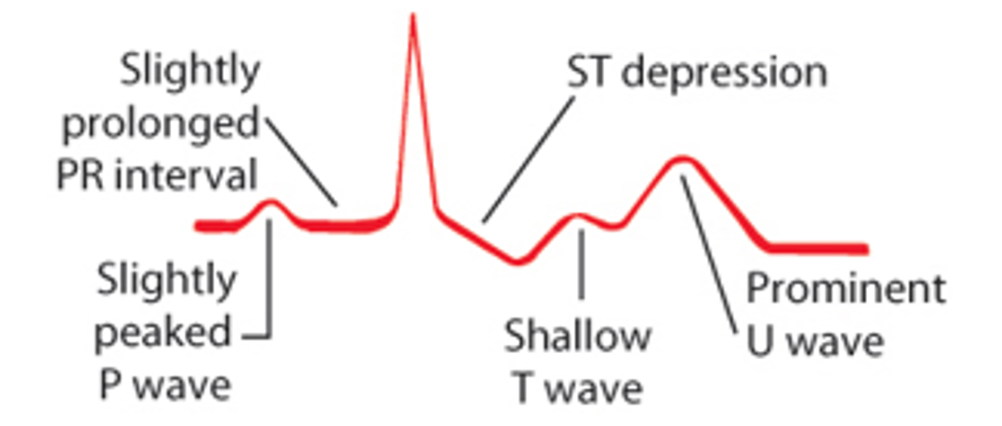 <p>bigger --> takes longer to charge</p>