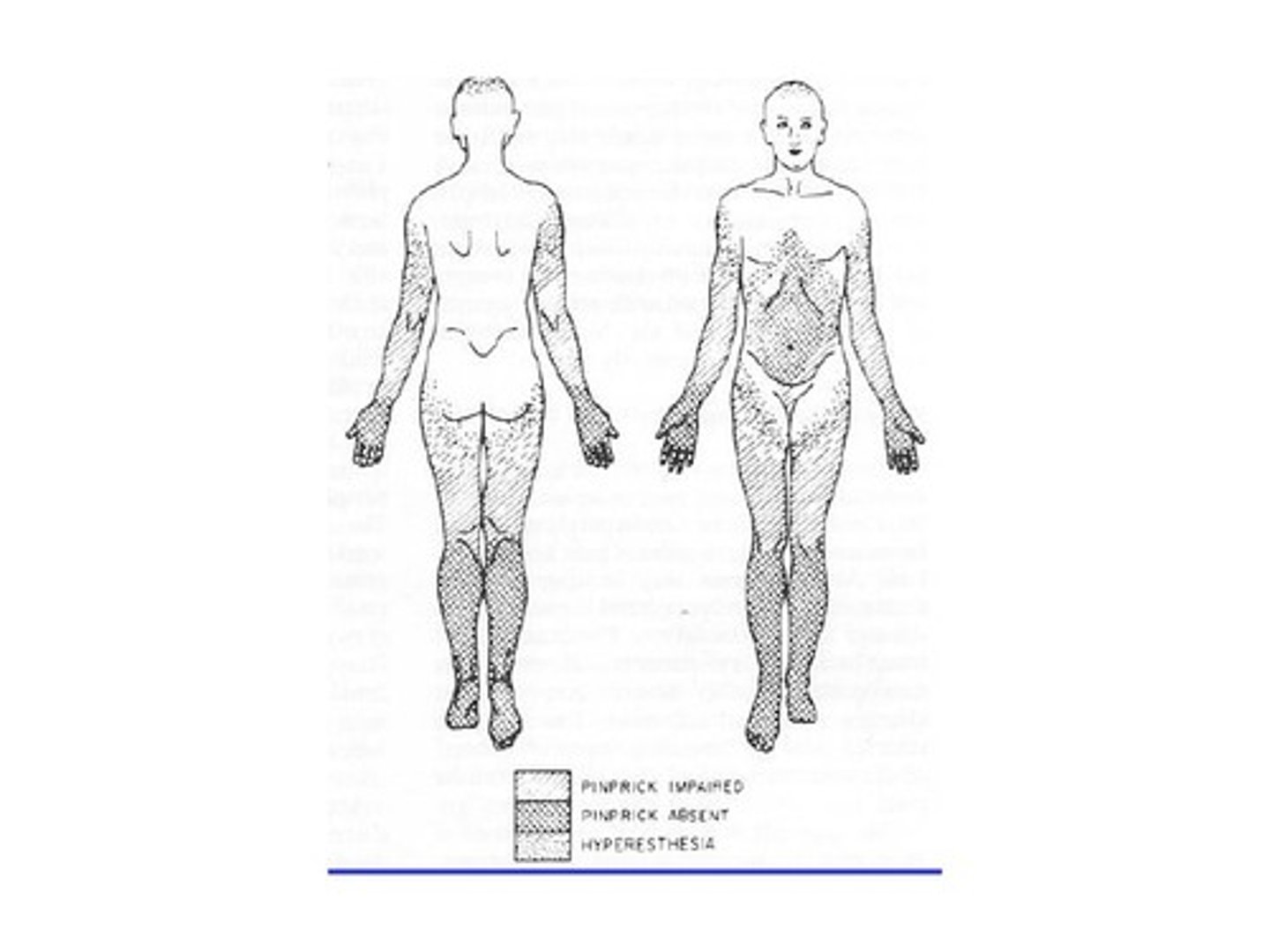 <p>usually the feet/ lower limbs</p>